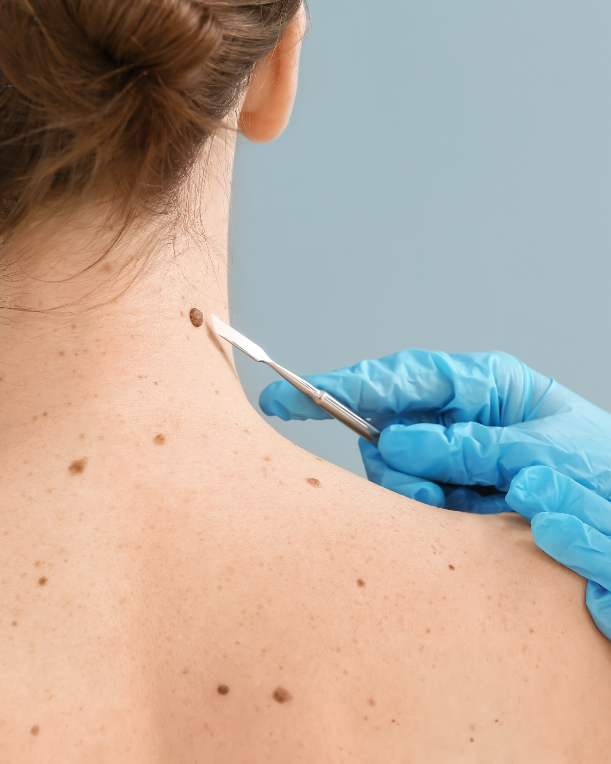 Don't be a Statistic - Be Sun Smart